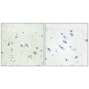 Gas6兔多抗,Gas6 Rabbit Polyclonal Antibody