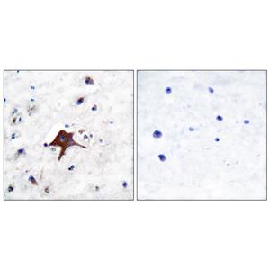 Glut3兔多抗,Glut3 Rabbit Polyclonal Antibody