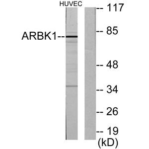 GRK 2兔多抗,GRK 2 Rabbit Polyclonal Antibody