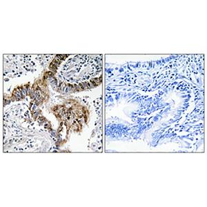 GRK 2兔多抗,GRK 2 Rabbit Polyclonal Antibody