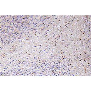 GROα兔多抗,GROα Rabbit Polyclonal Antibody