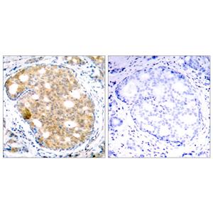 GSK3β兔多抗,GSK3β Rabbit Polyclonal Antibody
