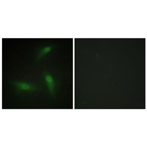 hnRNP A1兔多抗,hnRNP A1 Rabbit Polyclonal Antibody