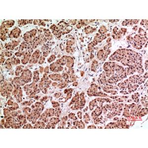 HPA1兔多抗,HPA1 Rabbit Polyclonal Antibody