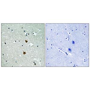 HSP27兔多抗,HSP27 Rabbit Polyclonal Antibody