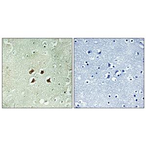 Huntingtin兔多抗,Huntingtin Rabbit Polyclonal Antibody