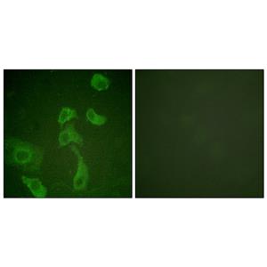 IL-2Rβ兔多抗,IL-2Rβ Rabbit Polyclonal Antibody