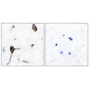 IL-3Rβ兔多抗,IL-3Rβ Rabbit Polyclonal Antibody