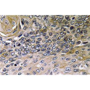 IL-8兔多抗,IL-8 Rabbit Polyclonal Antibody