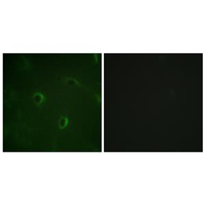 Insulin R兔多抗,Insulin R Rabbit Polyclonal Antibody