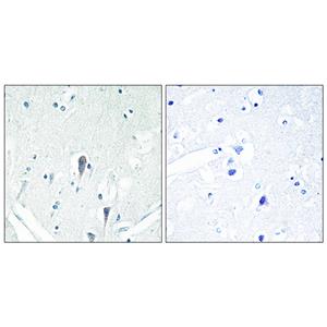 IRAK-M Rabbit Polyclonal Antibody | 兔多抗 | EnkiLife恩玑生命