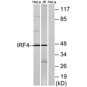 IRF-4 Rabbit Polyclonal Antibody | 兔多抗 | EnkiLife恩玑生命