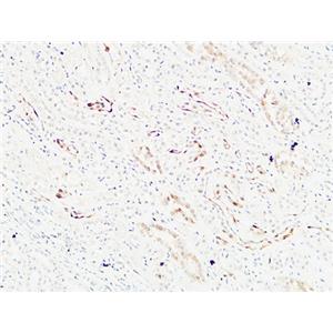 K-Ras兔多抗,K-Ras Rabbit Polyclonal Antibody