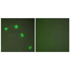 Ku-70兔多抗,Ku-70 Rabbit Polyclonal Antibody