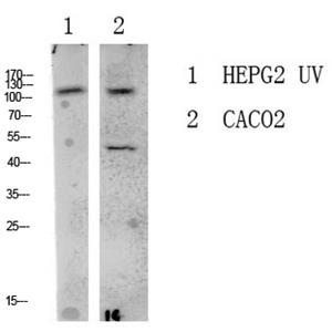 LATS1/2兔多抗,LATS1/2 Rabbit Polyclonal Antibody