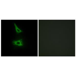 LI-cadherin兔多抗,LI-cadherin Rabbit Polyclonal Antibody