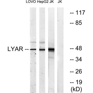 LYAR兔多抗,LYAR Rabbit Polyclonal Antibody