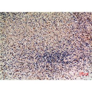 Lymphotactin兔多抗,Lymphotactin Rabbit Polyclonal Antibody