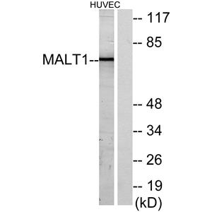 MALT1兔多抗,MALT1 Rabbit Polyclonal Antibody