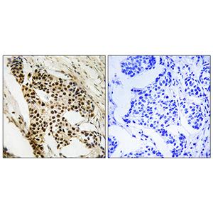MAPKAPK-2兔多抗,MAPKAPK-2 Rabbit Polyclonal Antibody