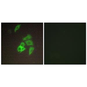Matriptase兔多抗,Matriptase Rabbit Polyclonal Antibody