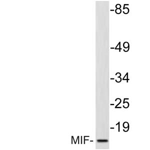 MIF兔多抗,MIF Rabbit Polyclonal Antibody
