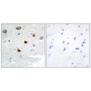 MKP-2兔多抗,MKP-2 Rabbit Polyclonal Antibody