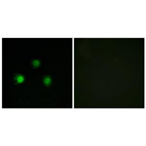 MSH2兔多抗,MSH2 Rabbit Polyclonal Antibody
