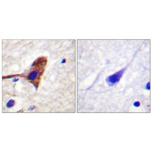 mTOR兔多抗,mTOR Rabbit Polyclonal Antibody