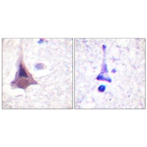 MYPT1兔多抗,MYPT1 Rabbit Polyclonal Antibody
