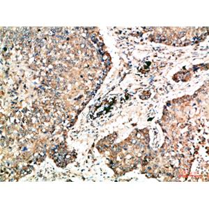 Napsin A兔多抗,Napsin A Rabbit Polyclonal Antibody