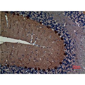 NF-L兔多抗,NF-L Rabbit Polyclonal Antibody