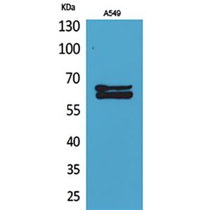 NUMB兔多抗,NUMB Rabbit Polyclonal Antibody
