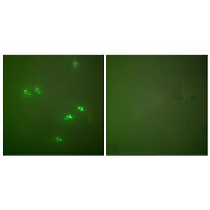 p14兔多抗,p14 Rabbit Polyclonal Antibody