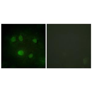 p68 RNA Helicase兔多抗,p68 RNA Helicase Rabbit Polyclonal Antibody