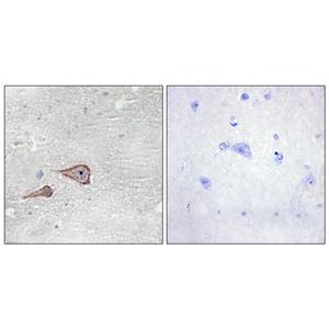 P-cadherin兔多抗,P-cadherin Rabbit Polyclonal Antibody