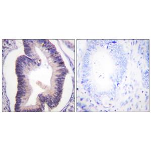 PFK-2 car兔多抗,PFK-2 car Rabbit Polyclonal Antibody