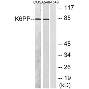 PFK-C兔多抗,PFK-C Rabbit Polyclonal Antibody