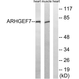 PIXβ兔多抗,PIXβ Rabbit Polyclonal Antibody