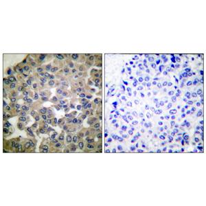 PLC γ1兔多抗,PLC γ1 Rabbit Polyclonal Antibody