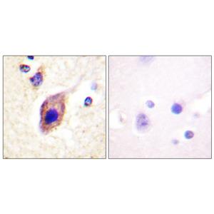 PLC γ2兔多抗,PLC γ2 Rabbit Polyclonal Antibody