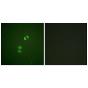 Plk兔多抗,Plk Rabbit Polyclonal Antibody