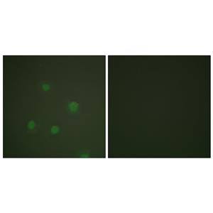 PR兔多抗,PR Rabbit Polyclonal Antibody