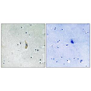 Presenilin 1兔多抗,Presenilin 1 Rabbit Polyclonal Antibody
