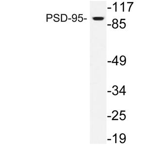 PSD-95兔多抗,PSD-95 Rabbit Polyclonal Antibody
