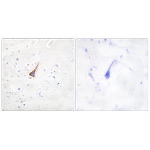 PTP1B兔多抗,PTP1B Rabbit Polyclonal Antibody