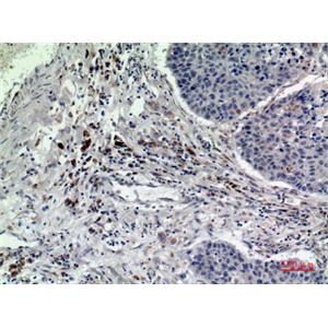 Rab 5A兔多抗,Rab 5A Rabbit Polyclonal Antibody