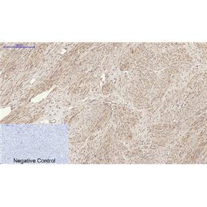RANKL兔多抗,RANKL Rabbit Polyclonal Antibody