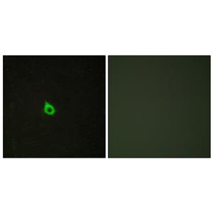 RECK兔多抗,RECK Rabbit Polyclonal Antibody