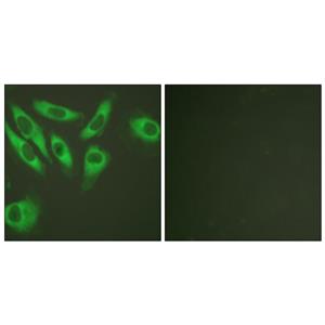 Ribosomal Protein S6兔多抗,Ribosomal Protein S6 Rabbit Polyclonal Antibody